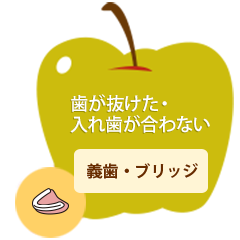 歯が抜けた・入れ歯が合わない義歯・ブリッジ