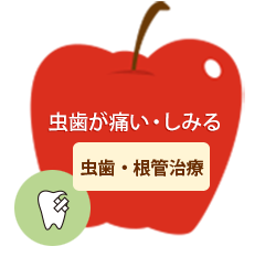 銀歯が気になる・歯を白くしたい虫歯・根管治療