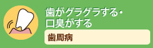 歯がグラグラする・口臭がする歯周病